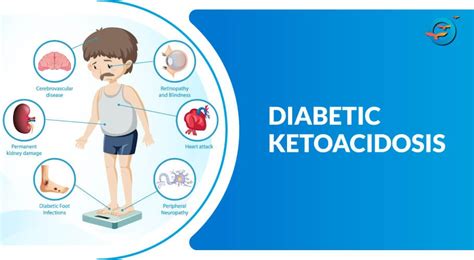 Diabetic Ketoacidosis