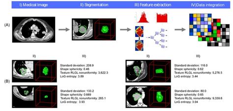 Figures And Data In Defining The Biological Basis Of Radiomic Phenotypes In Lung Cancer Elife