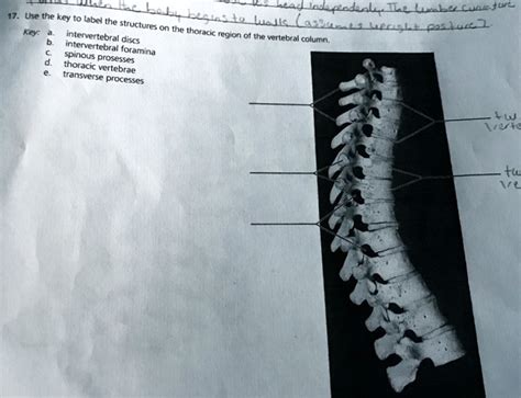 17 Use The Key To Label The Structures On The Thoracic Region Of The