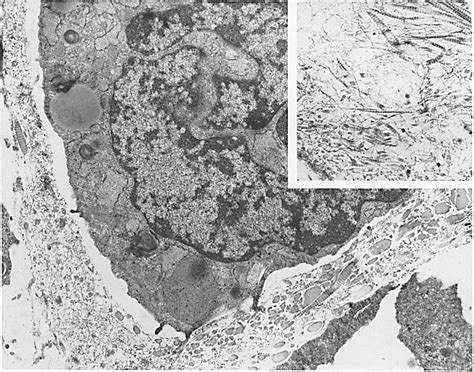 Electron Micrograph Of C1 Chondrocyte Performed On A Nodule Section