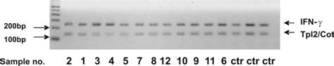 The Tpl Cot Genomic Locus Is Not Amplified In The T Cell Neoplasms