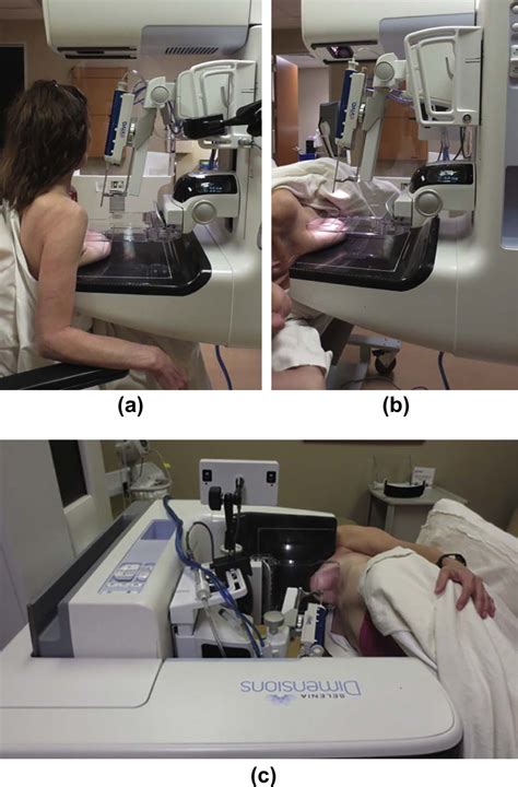 Implementation Of Upright Digital Breast Tomosynthesis Guided