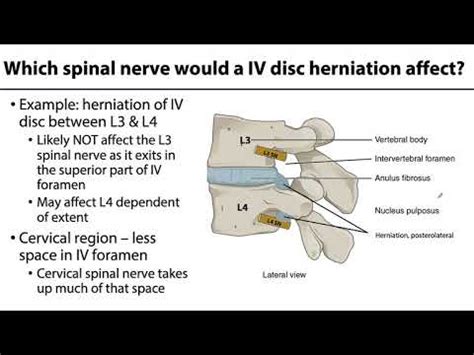 Back and Spinal Cord LO 8 - Spinal Nerve: Exiting IV Foramina - YouTube