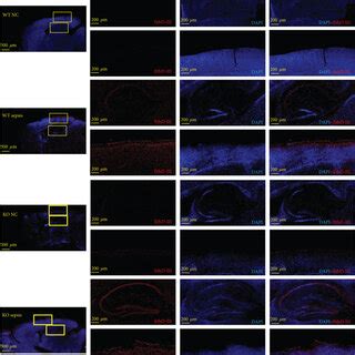 Cit Protects Against LPS Induced Activation Of The NLRP3 Inflammasome