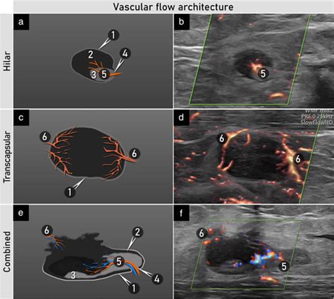 Terms Definitions And Measurements To Describe Sonographic Features Of