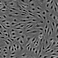 Human Brain Microvascular Endothelial Cells Innoprot Brain Cell System