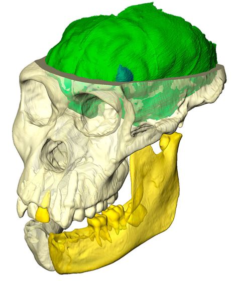 Gap In Human Brain Evolution Data Covered