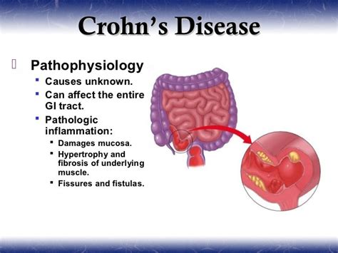 Gastroenterology