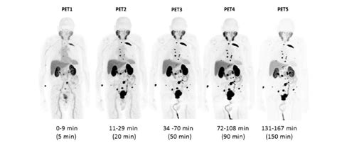 2022 Prostate Cancer Highlight PSMA PET Imaging In Prostate Cancer