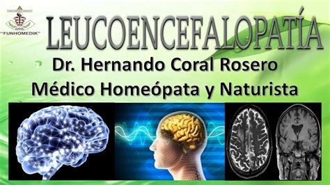 Leucoencefalopatia Infecci N Que Ocasiona Da O Al Material Que Cubre