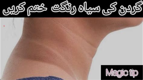 Neck Whitening Cream At Home Get Rid Of The Dark Neck In Minutes