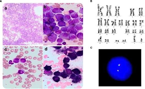 Frontiers Case Report Identification Of A Novel HNRNPC RARG Fusion