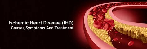 Ischemic Heart Disease Causes Symptoms Treatment