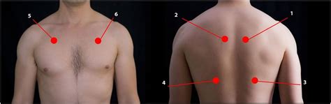 Illustration Showing The Different Places Where Lung Sounds Were