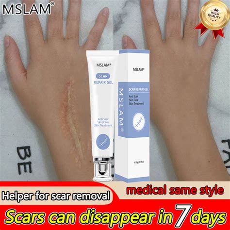 Medical Helper To Eliminate Scars In Days Mslam Scar Removal Cream