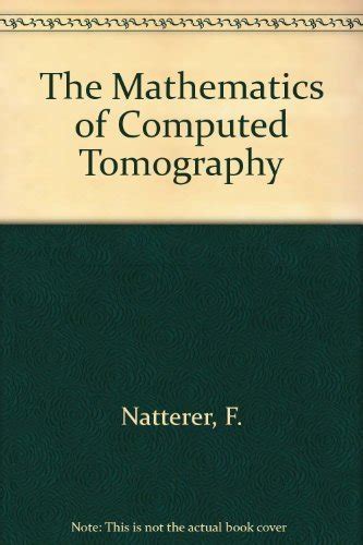 The Mathematics of Computerized Tomography: 9780471909590: Medicine ...