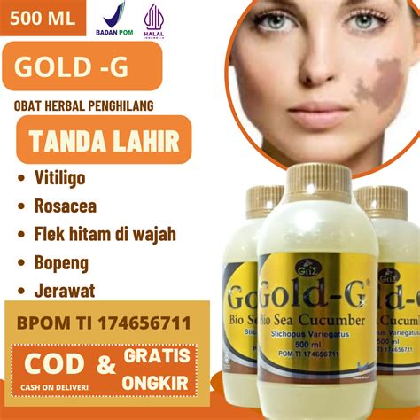 Jual Bisa Cod Obat Cream Penghilang Tanda Lahir Coklat Merah Tompel