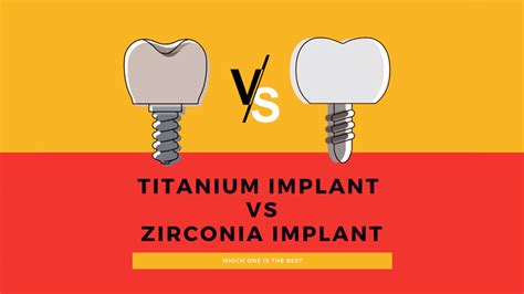 Titanium Implant Vs Zirconia Implant Which One Is Best