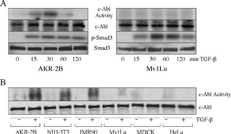 Transforming Growth Factor Activation Of C Abl Is Independent Of