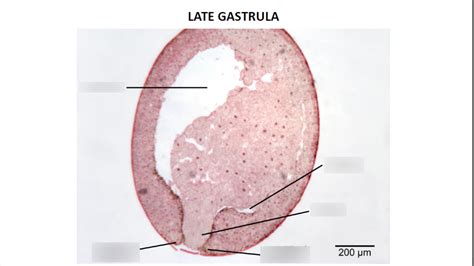 Gastrula Diagram