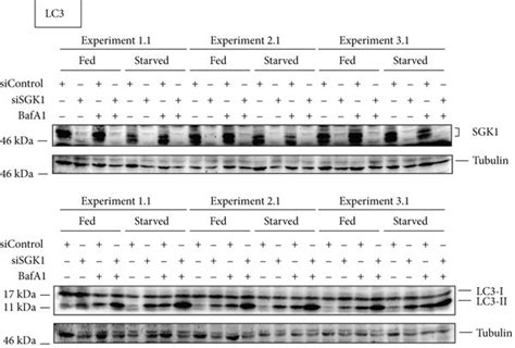 Elevated Lc Lipidation In Sgk Depleted Cells Stable Gfp Wipi