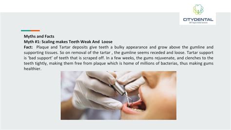 Ppt Myths Versus Facts Of Teeth Polishing Scaling Powerpoint