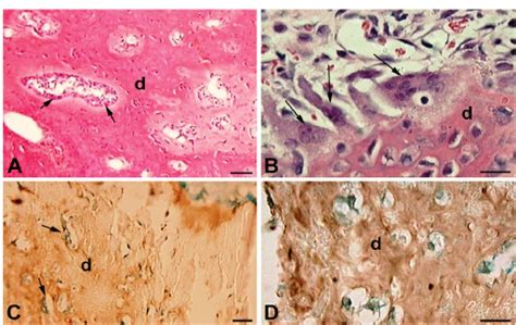 Photomicrographys Of Transplants Of Apical Papilla Dpt Osteodentin