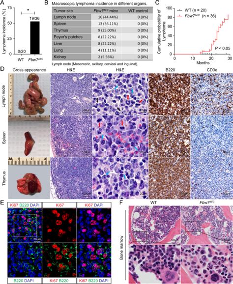 Selective Deletion Of E Ubiquitin Ligase Fbw In Ve Cadherin Positive