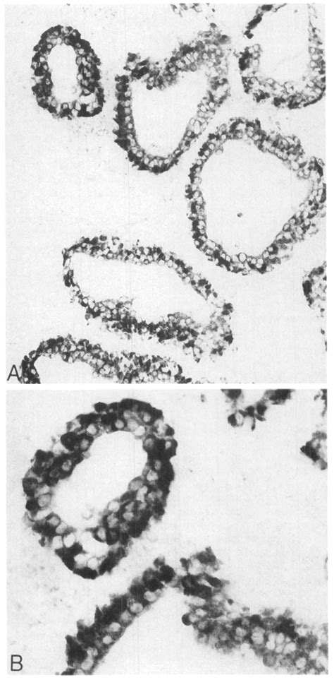 In Situ Hybridization The Epstein Barr Virus Probe Results In A Download Scientific Diagram