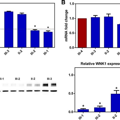 Loss Of PGP9 5 Positive Intra Epidermal Sensory Fibers IENF In The