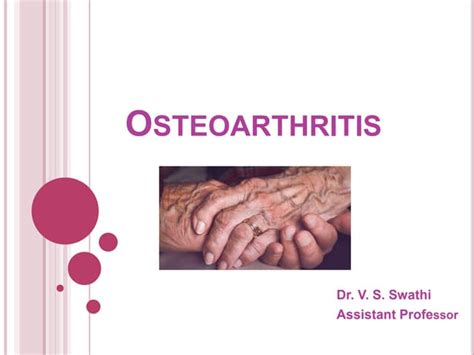 Osteoarthritis Ppt