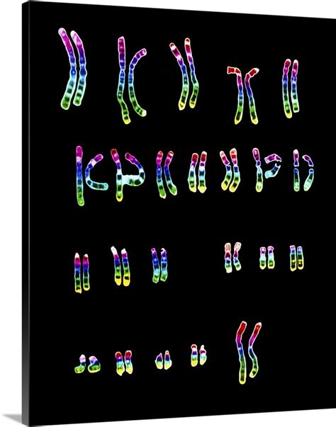 Coloured LM of a normal female karyotype Wall Art, Canvas Prints ...