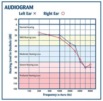 Understanding Your Hearing Test - Hearing Industries Association