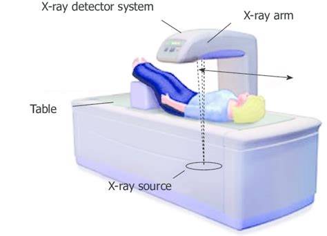 Figure Dual Energy X Ray Absorptiometry Dxa Showing The Off