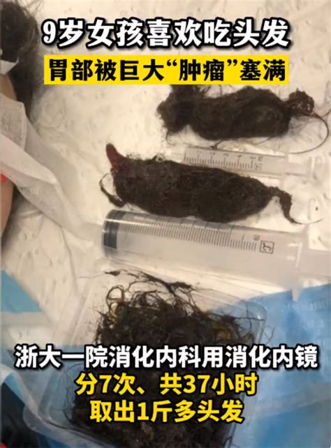 12岁女生压力大吃毛发胃里长结石，关于异食癖，家长应如何防范？ 知乎