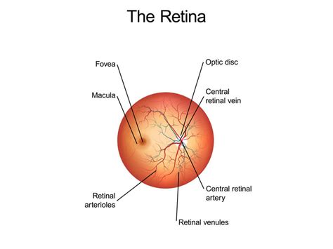 Retinal Vascular Disease Symptoms | Retina Associates Kansas City