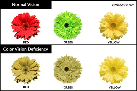 Different Type Of Blindness Four Prevalent Different Types Of