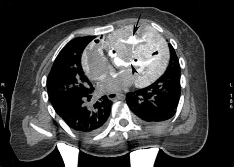 Post Mortem Imaging In Adults Diagnostic Histopathology