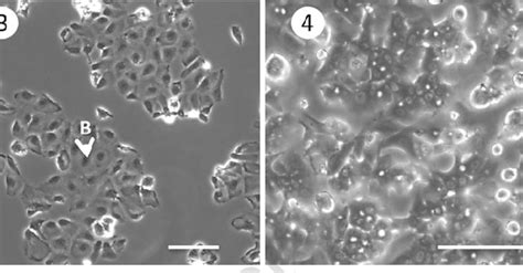 Morphology In Phase Contrast Of Differentiated Heparg Cells 1 And