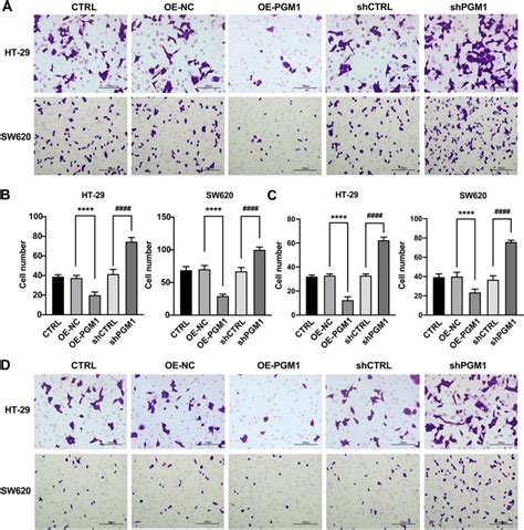 PGM1 Inhibited Cell Invasion And Migration A Migration Ability Of The