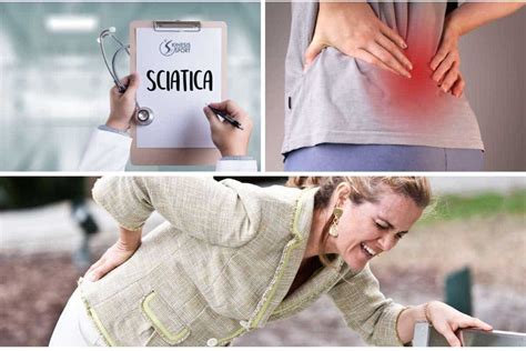 Sciatica Come Curarla Con La Fisioterapia Dott Fabio Marino