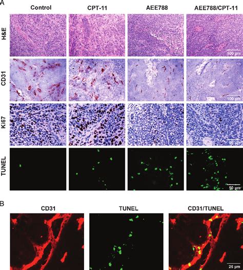 Analysis For Cell Proliferation Apoptosis And MVD A Cecal Tumors