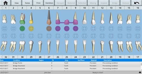 Printable Dental Charting Symbols