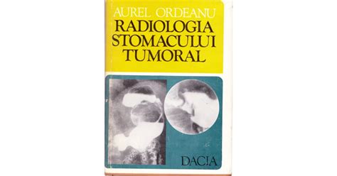 AS AUREL ORDEANU RADIOLOGIA STOMACULUI TUMORAL Okazii Ro