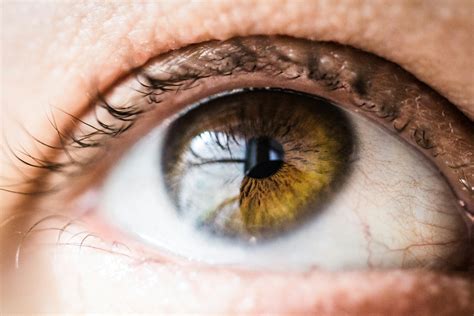 Eye Allergies: Symptoms, Causes & Remedies