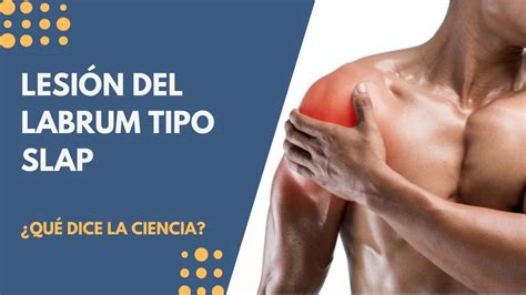 LESIÓN DEL LABRUM DEL HOMBRO SLAP Qué es Cómo se diagnostica