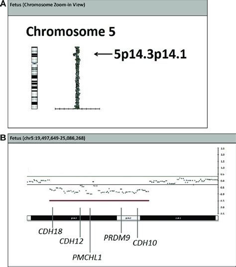 Array Comparative Genomic Hybridization Acgh On The Dna Extracted