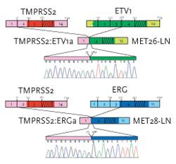 Gene fusion identified in prostate cancer | The Scientist Magazine®