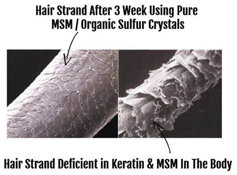 MSM For Hair Growth - Natural and Effective.