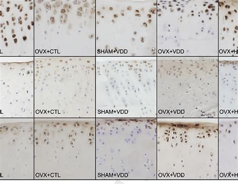 Representative Expression Of Transforming Growth Factor B Tgf B